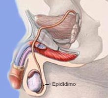 EPIDIDIMITIS - HIPERnatural.COM